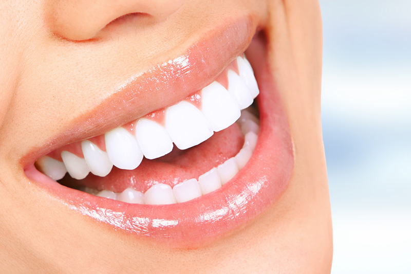 Cosmetic Dentistry in Rosharon